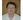 行政院衛生署新竹醫院牙科楊智仁主任表示，一位20多歲的妙齡女子，因為滿口的棕灰色牙而求診，經檢查後研判應是小時候生病時家人自行至藥局買抗生素給她服用，長期服用四環黴素所造成的染色。後來透過瓷牙贗復後，此妙齡女子立即擁有一口潔白貝齒。